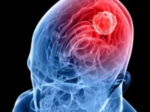 Meningite meningococcica: grave 35enne di Guastalla